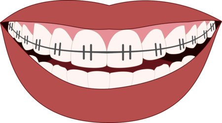 Yann Guez orthodontie