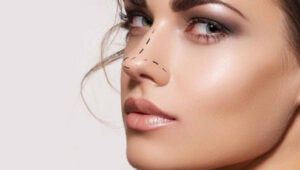 Changer la forme du nez : la technique la plus efficace